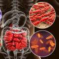 The Importance of Gut Bacteria in Digestive Health